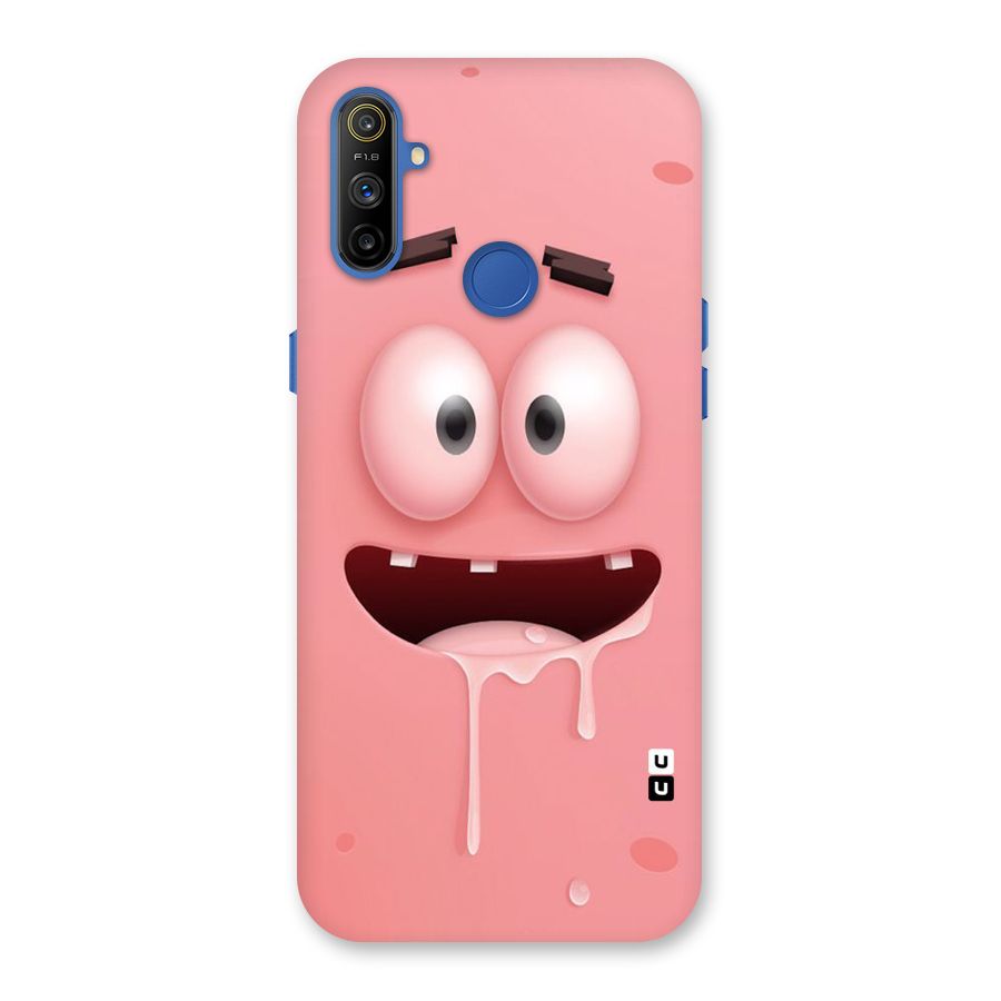 Watery Mouth Back Case for Realme Narzo 10A