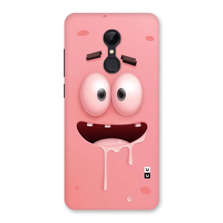 Watery Mouth Back Case for Redmi 5
