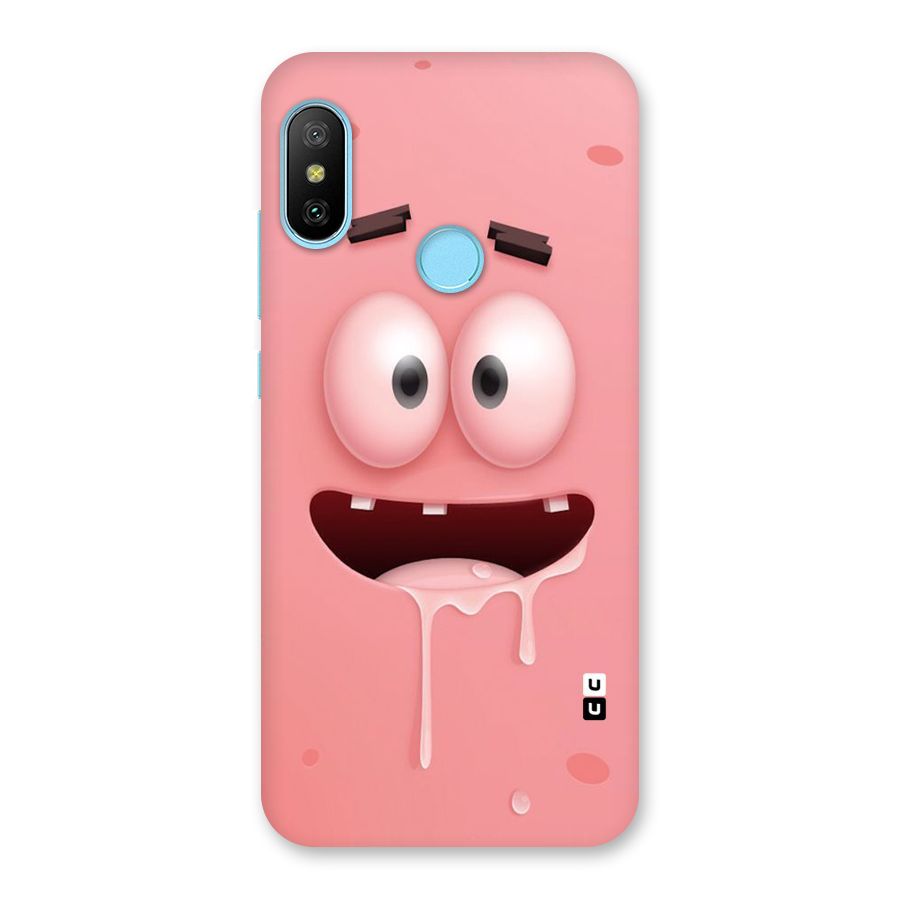 Watery Mouth Back Case for Redmi 6 Pro