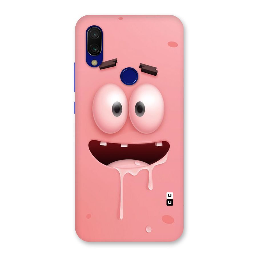 Watery Mouth Back Case for Redmi 7