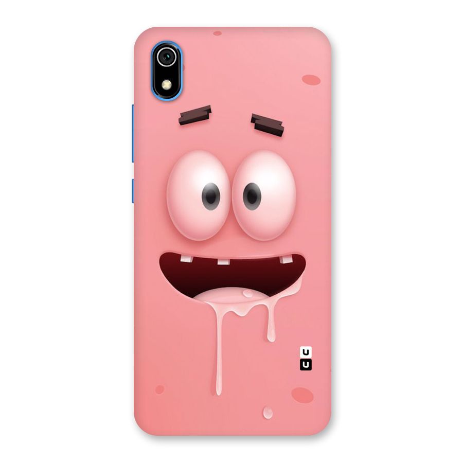 Watery Mouth Back Case for Redmi 7A