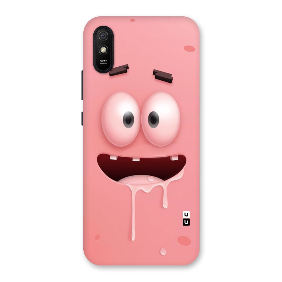 Watery Mouth Back Case for Redmi 9A