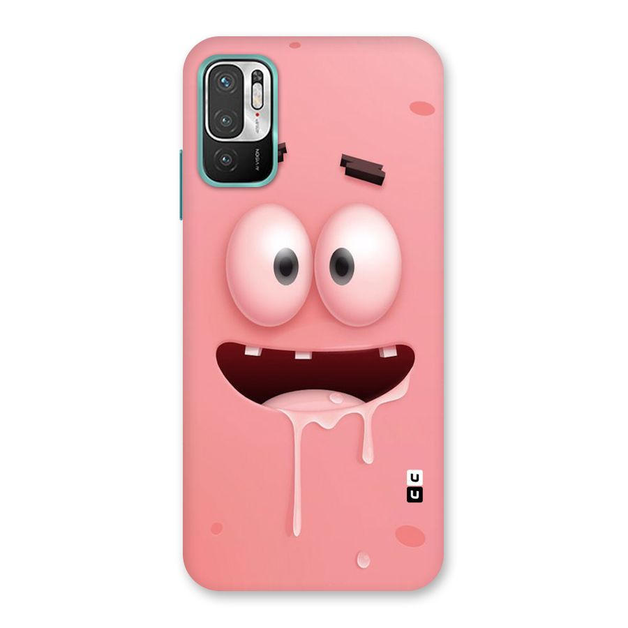 Watery Mouth Back Case for Redmi Note 10T 5G