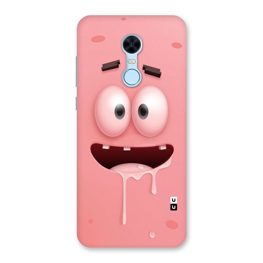 Watery Mouth Back Case for Redmi Note 5