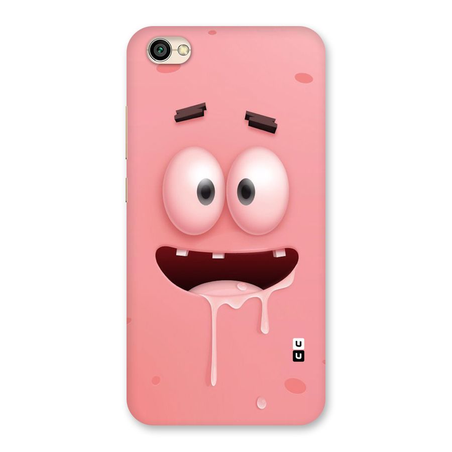 Watery Mouth Back Case for Redmi Y1 Lite