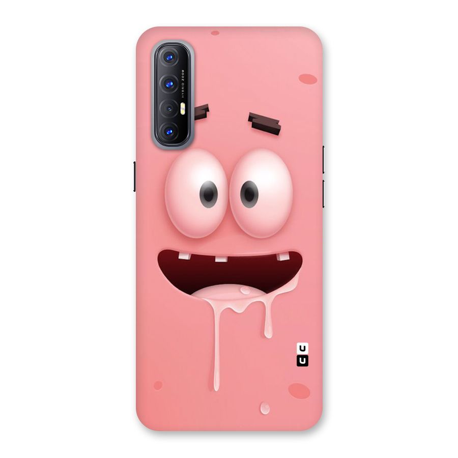 Watery Mouth Back Case for Reno3 Pro