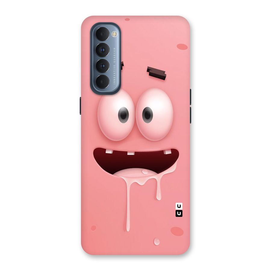 Watery Mouth Back Case for Reno4 Pro
