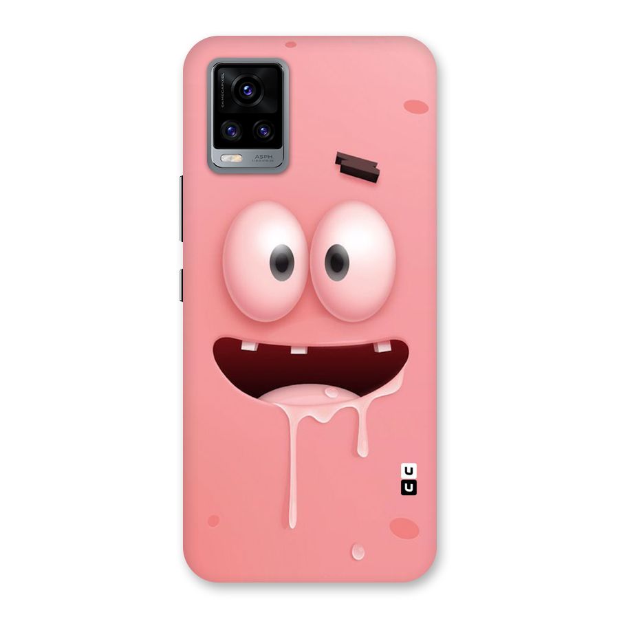 Watery Mouth Back Case for Vivo V20