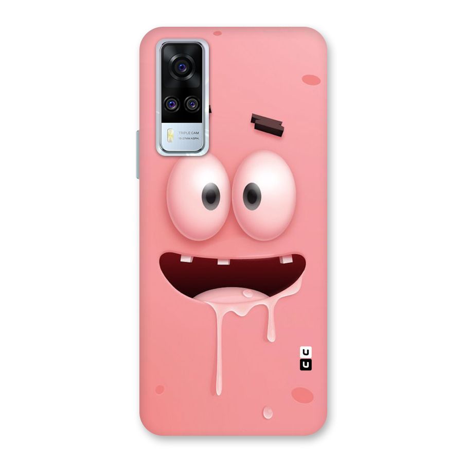 Watery Mouth Back Case for Vivo Y31