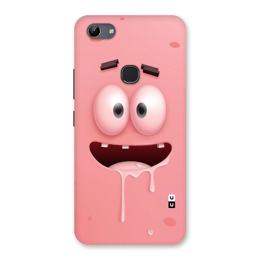 Watery Mouth Back Case for Vivo Y81