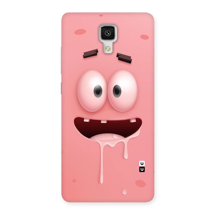 Watery Mouth Back Case for Xiaomi Mi 4