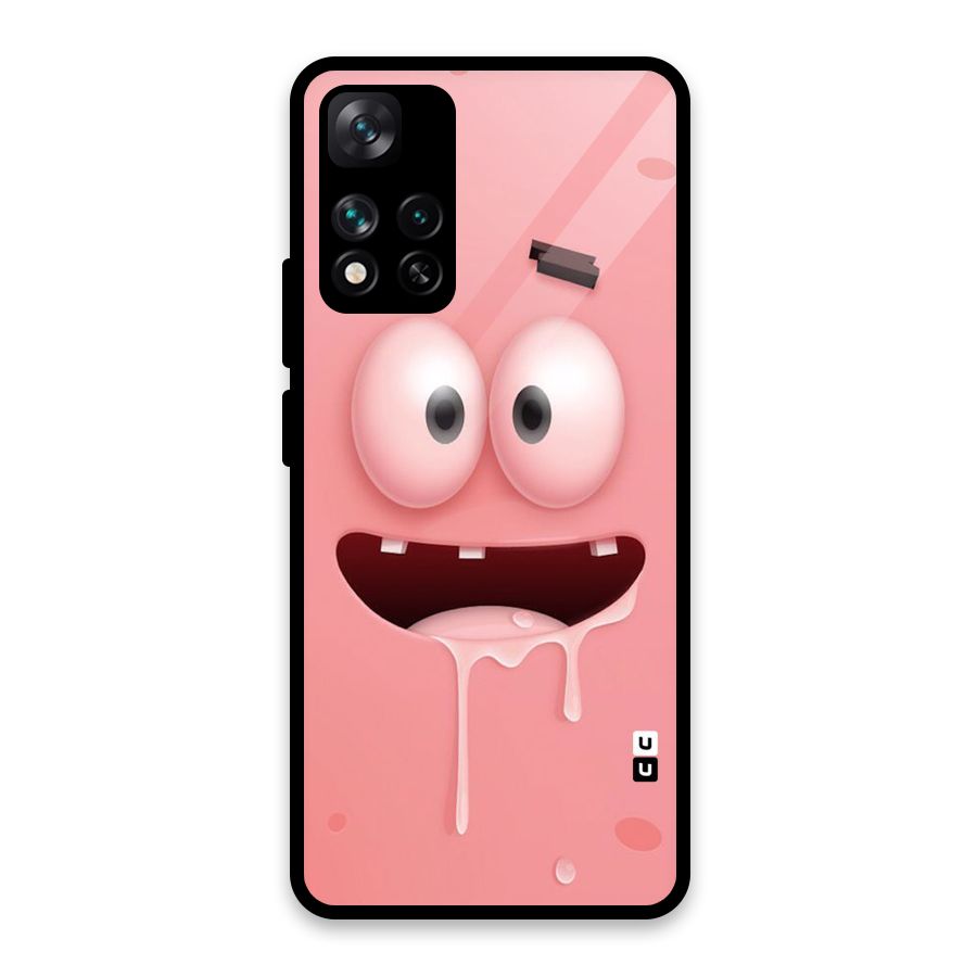 Watery Mouth Glass Back Case for Xiaomi 11i HyperCharge 5G