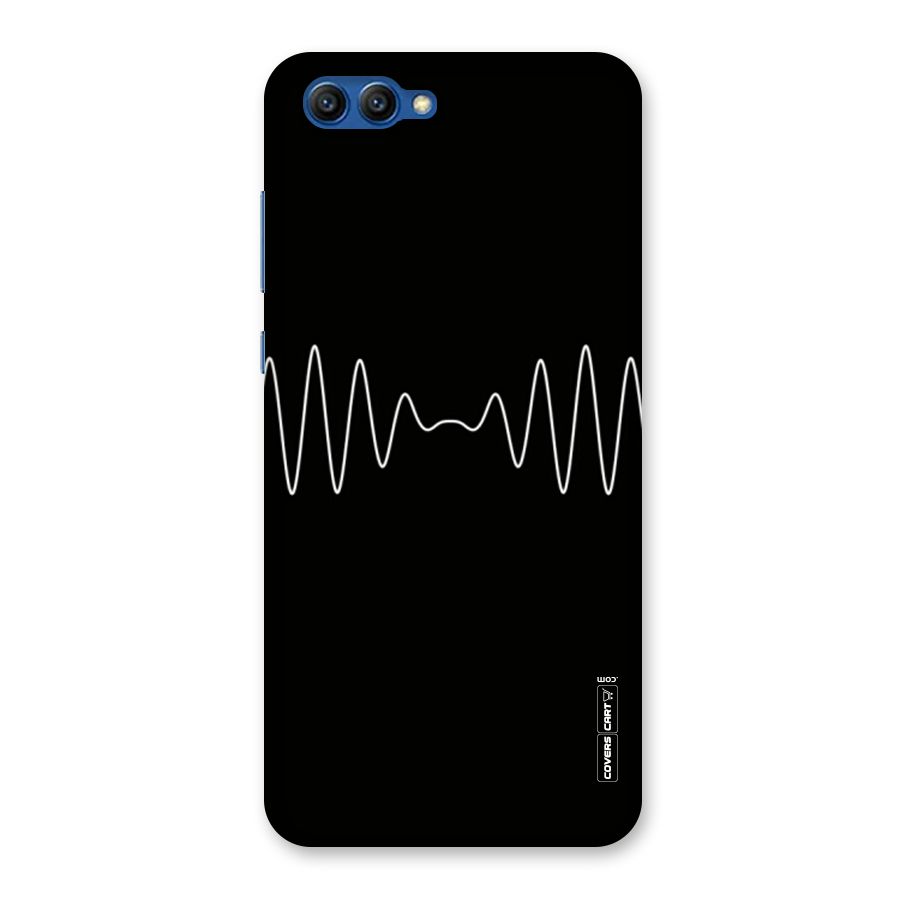 White Minimal Thread Back Case for Honor View 10