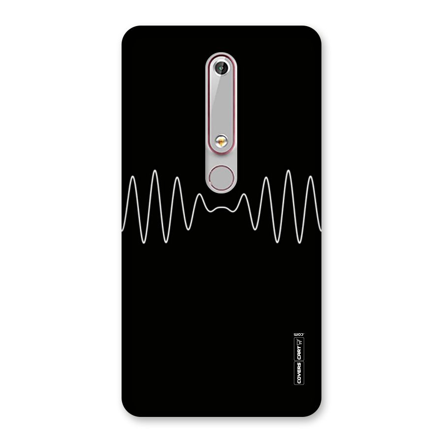 White Minimal Thread Back Case for Nokia 6.1