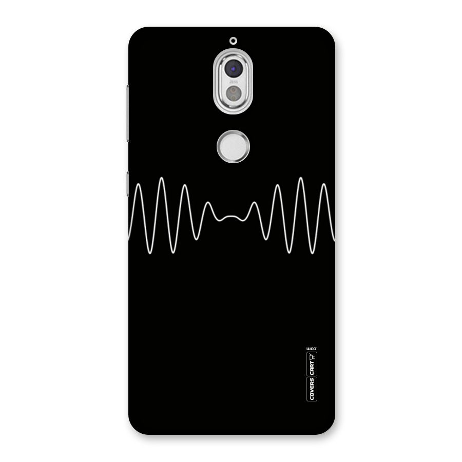 White Minimal Thread Back Case for Nokia 7