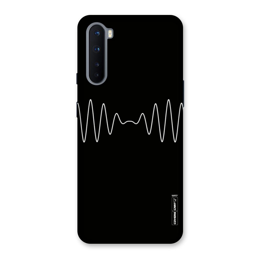 White Minimal Thread Back Case for OnePlus Nord