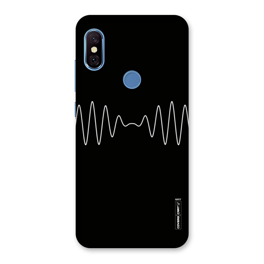 White Minimal Thread Back Case for Redmi Note 6 Pro