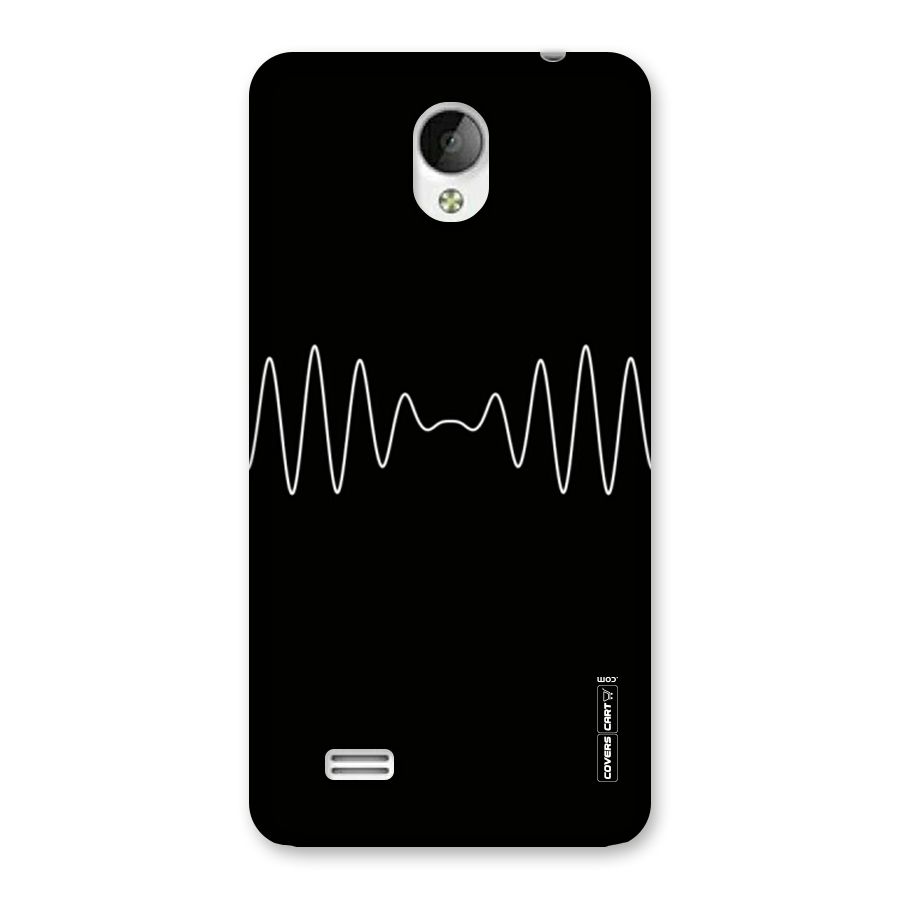 White Minimal Thread Back Case for Vivo Y21