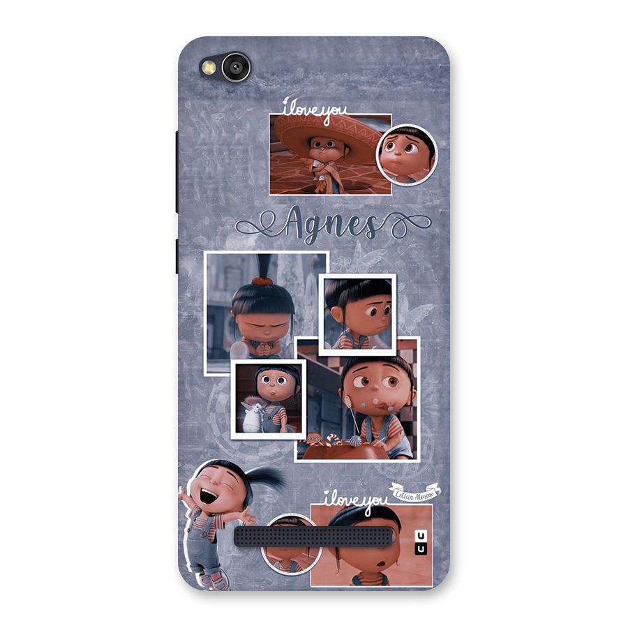 Agnes Back Case for Redmi 4A