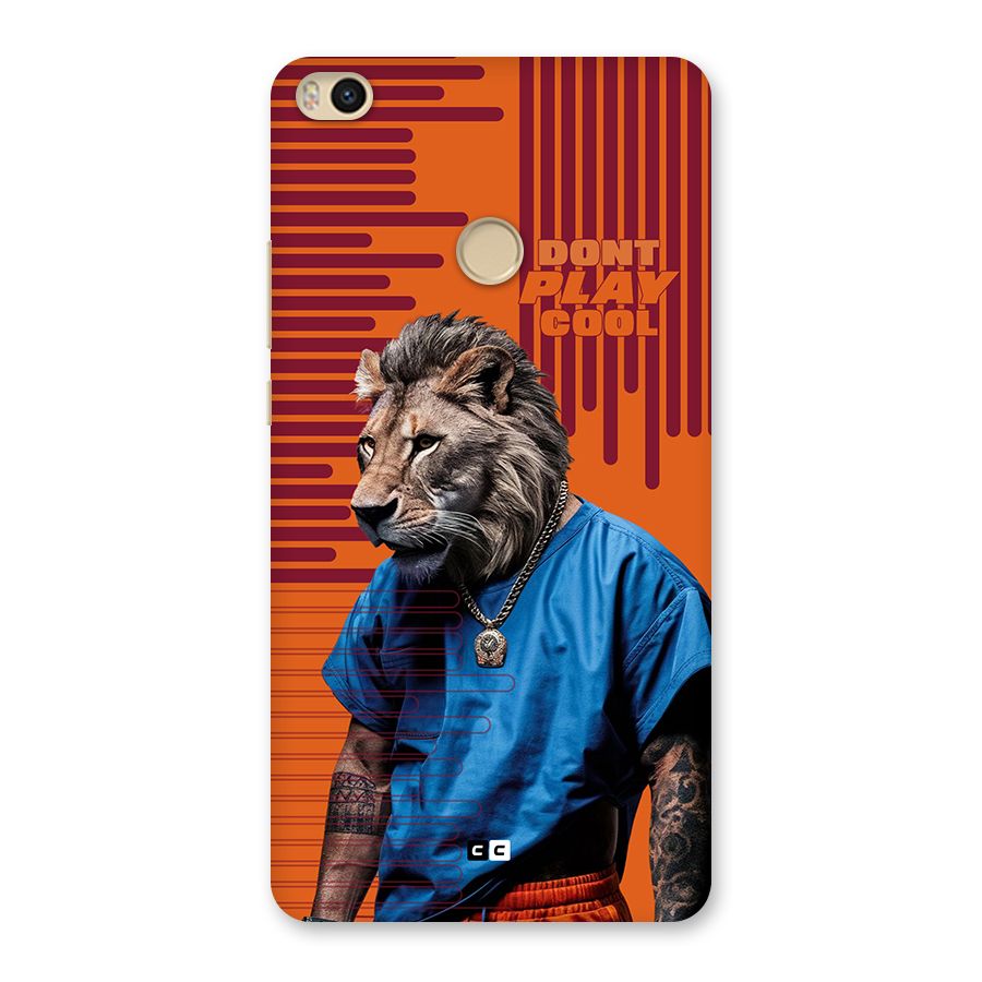 Dont Play Cool Back Case for Mi Max 2