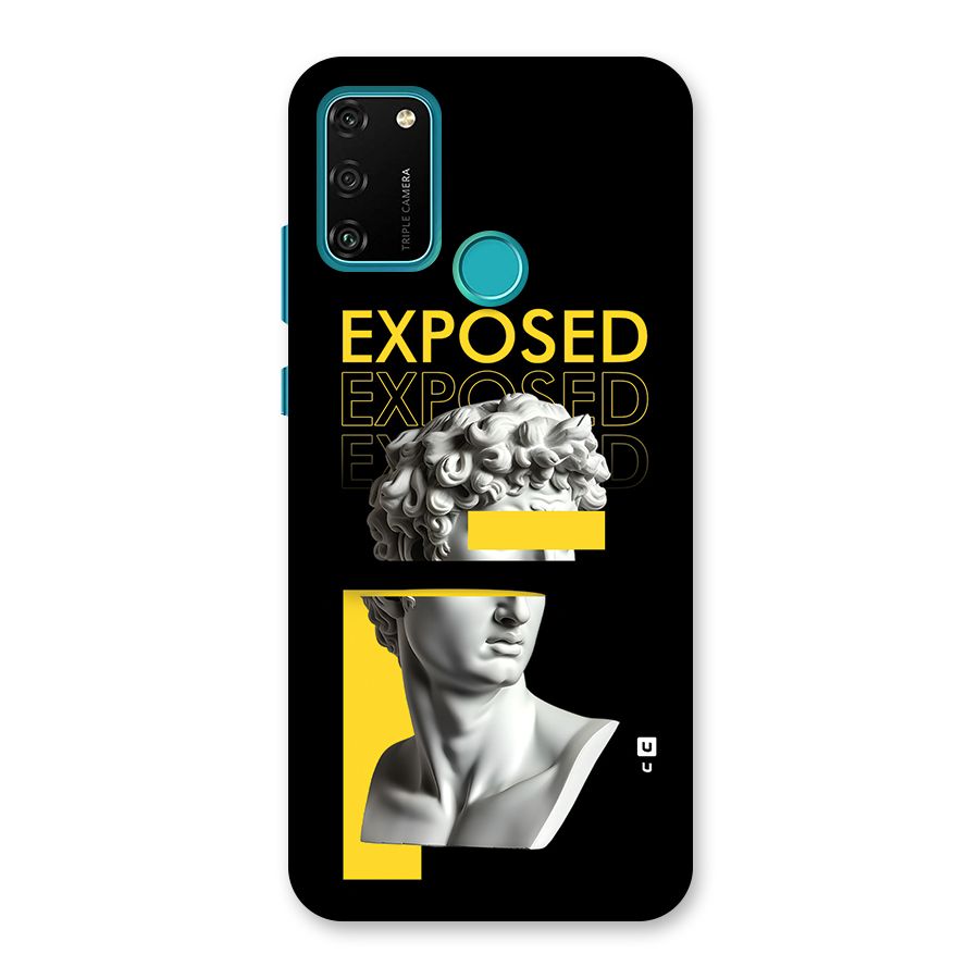 Exposed Sculpture Back Case for Honor 9A