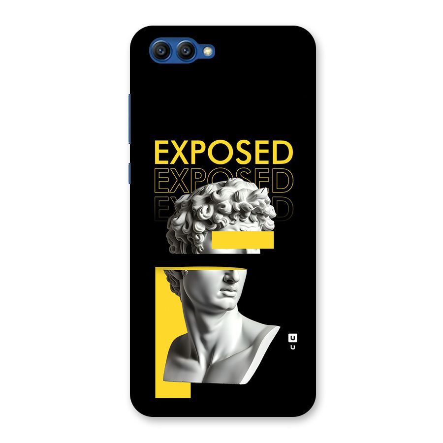 Exposed Sculpture Back Case for Honor View 10
