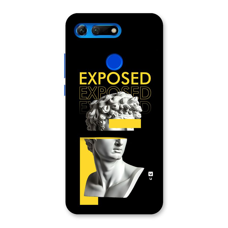 Exposed Sculpture Back Case for Honor View 20