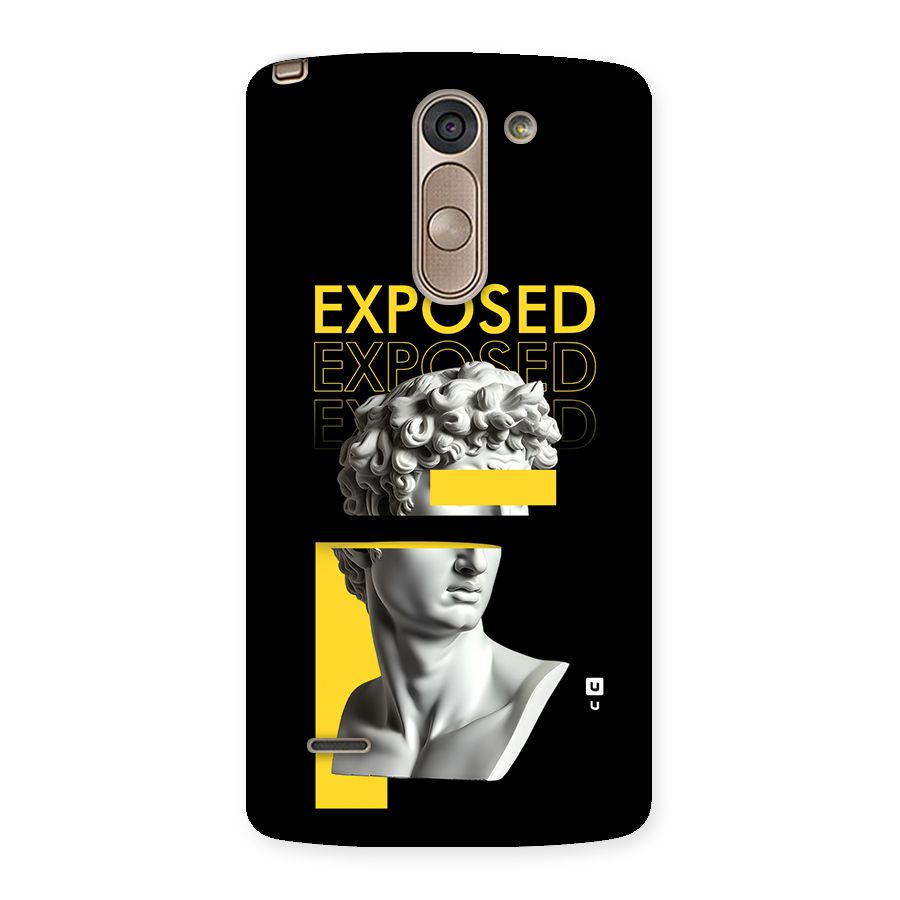 Exposed Sculpture Back Case for LG G3 Stylus