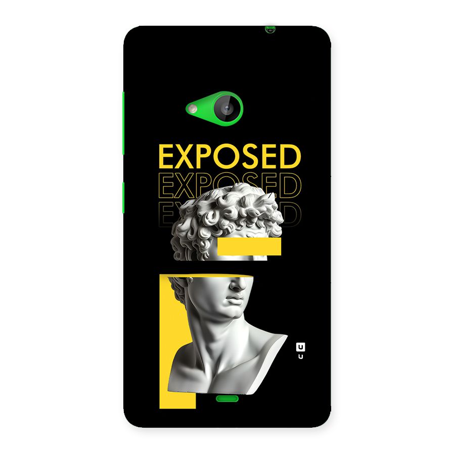 Exposed Sculpture Back Case for Lumia 535
