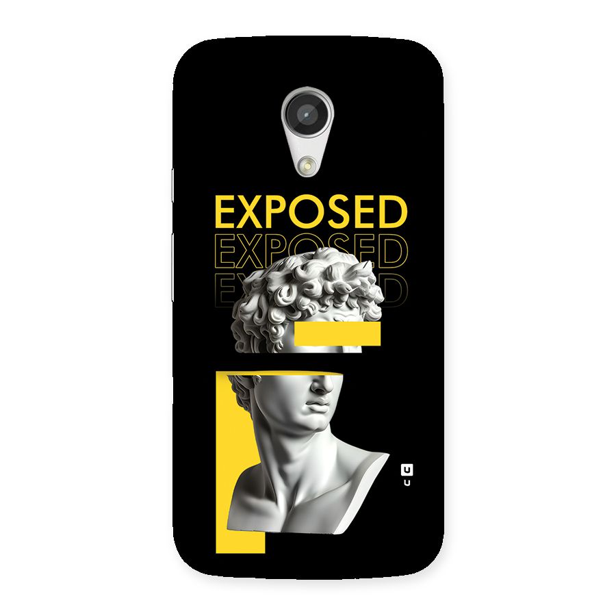 Exposed Sculpture Back Case for Moto G 2nd Gen