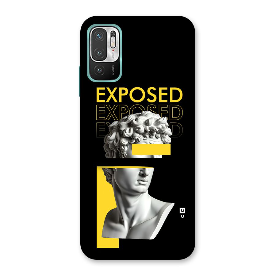 Exposed Sculpture Back Case for Redmi Note 10T 5G
