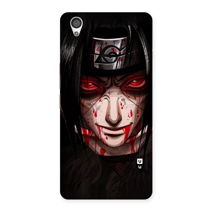 Itachi Uchiha Red Eyes Back Case for OnePlus X