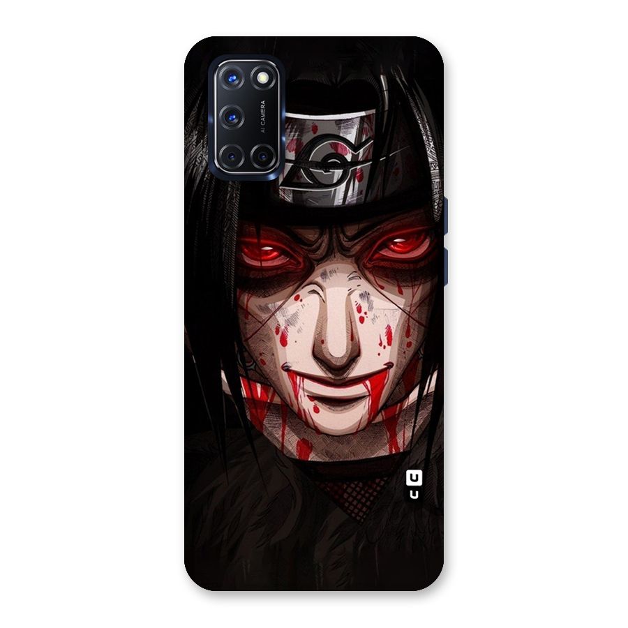 Itachi Uchiha Red Eyes Back Case for Oppo A52