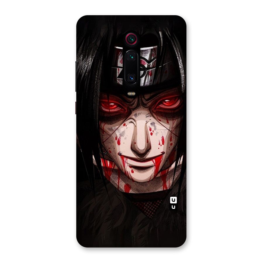 Itachi Uchiha Red Eyes Back Case for Redmi K20