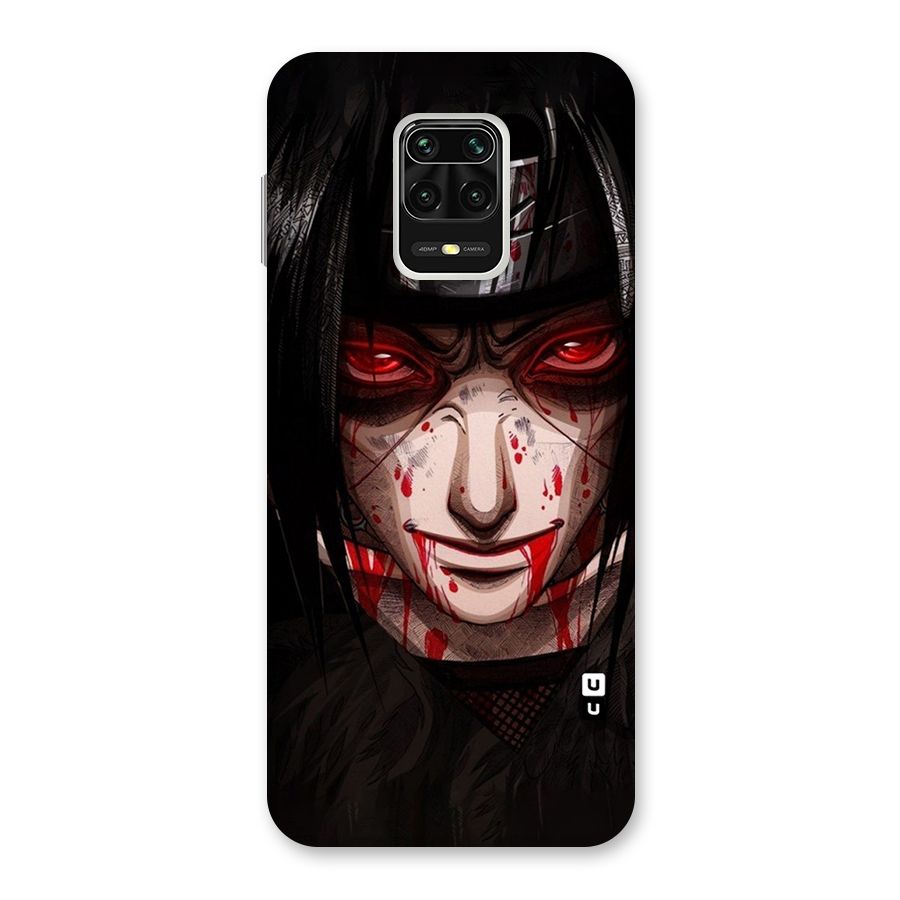 Itachi Uchiha Red Eyes Back Case for Redmi Note 9 Pro