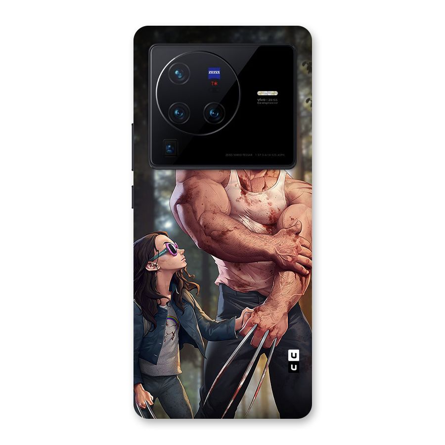 Laura Logan Back Case for Vivo X80 Pro