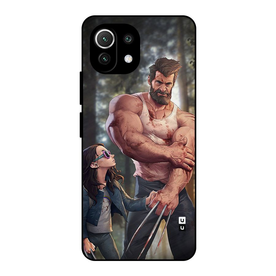 Laura Logan Metal Back Case for Mi 11 Lite NE 5G