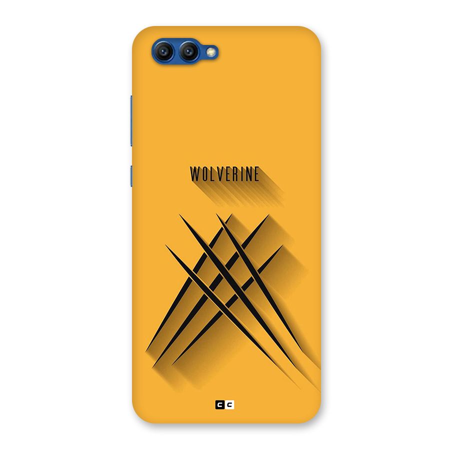 Logan Claw Back Case for Honor View 10