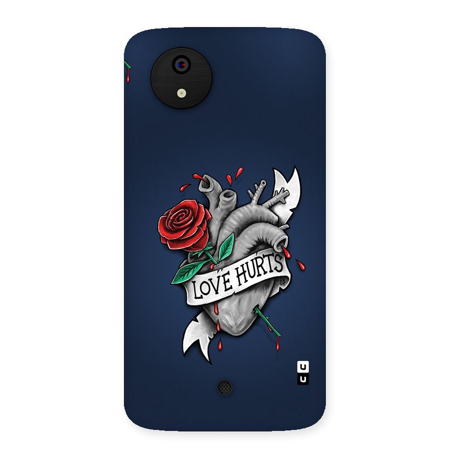 Love Hurts Back Case for Canvas A1  AQ4501
