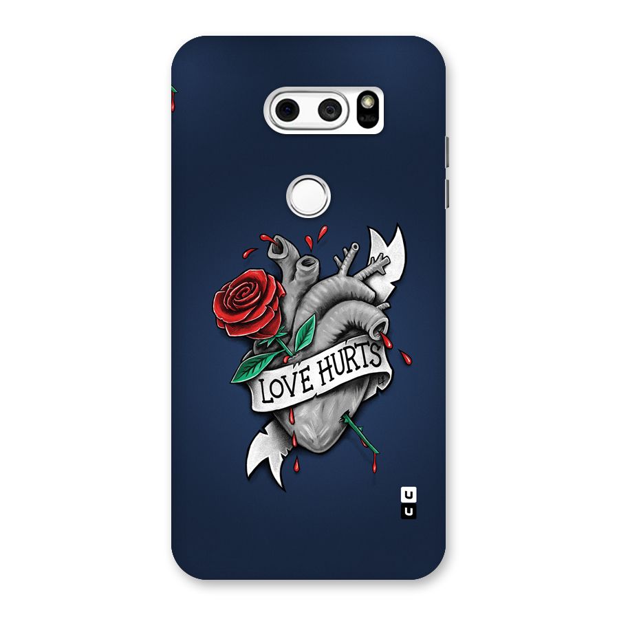 Love Hurts Back Case for LG V30