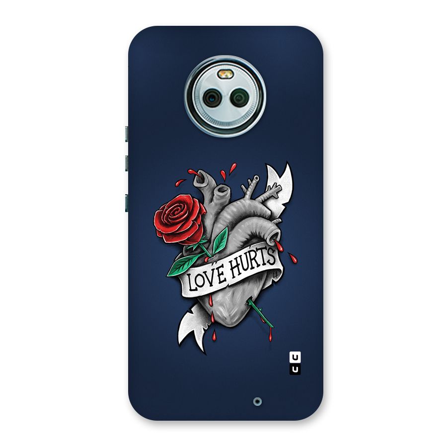 Love Hurts Back Case for Moto X4