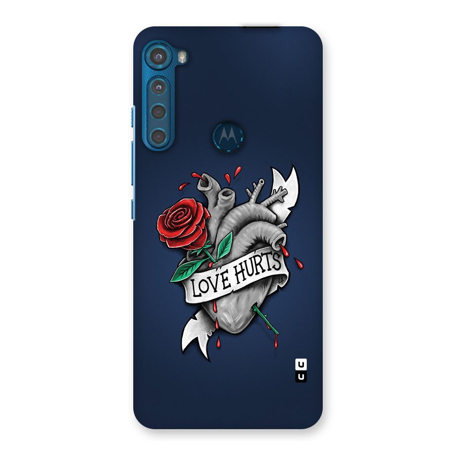 Love Hurts Back Case for Motorola One Fusion Plus