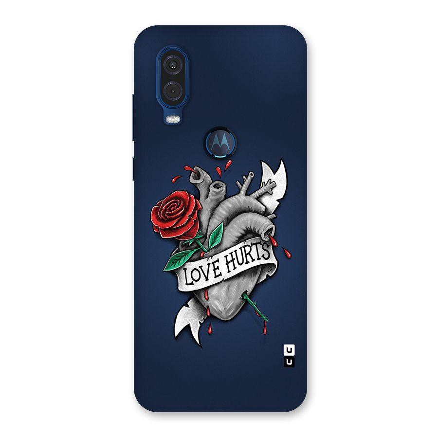Love Hurts Back Case for Motorola One Vision