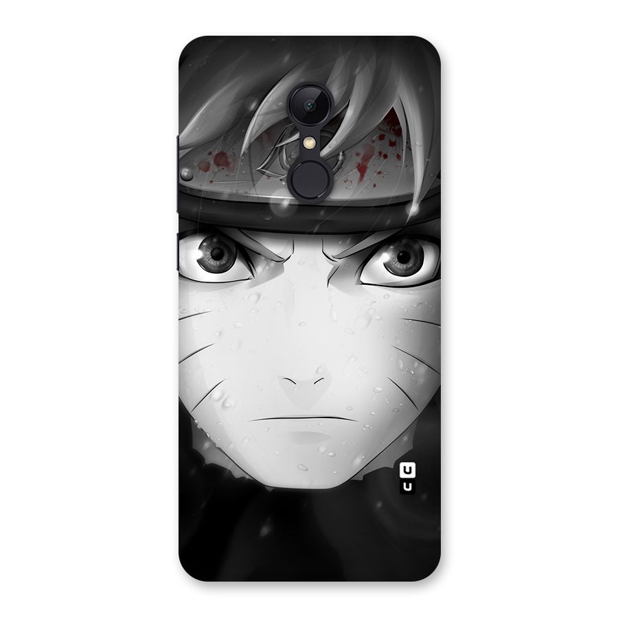 Naruto Monochrome Back Case for Redmi 5