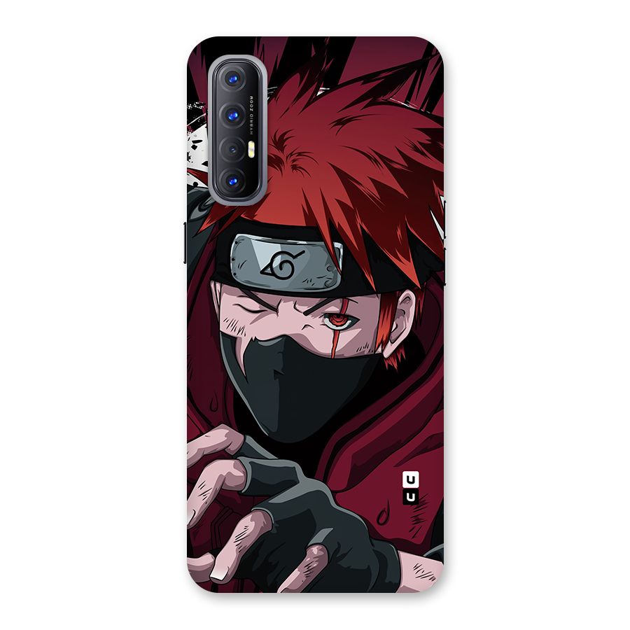 Naruto Ready Action Back Case for Oppo Reno3 Pro