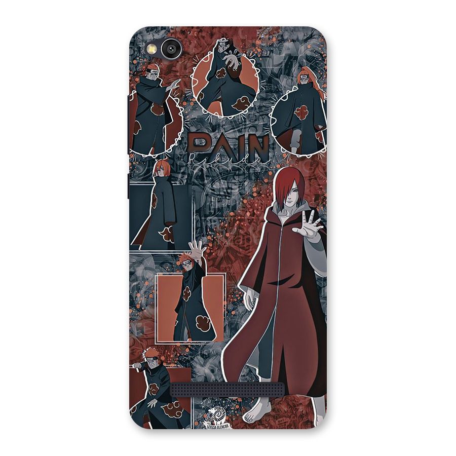 Pain Group Back Case for Redmi 4A