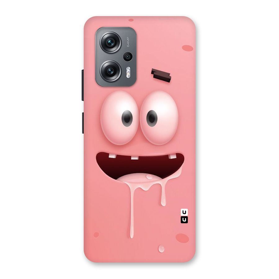 Watery Mouth Back Case for Redmi K50i