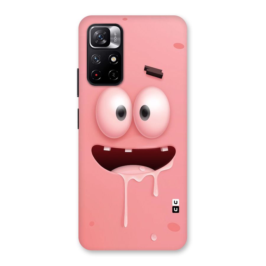Watery Mouth Back Case for Redmi Note 11T 5G