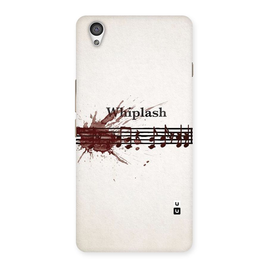 Music Notes Splash Back Case for OnePlus X