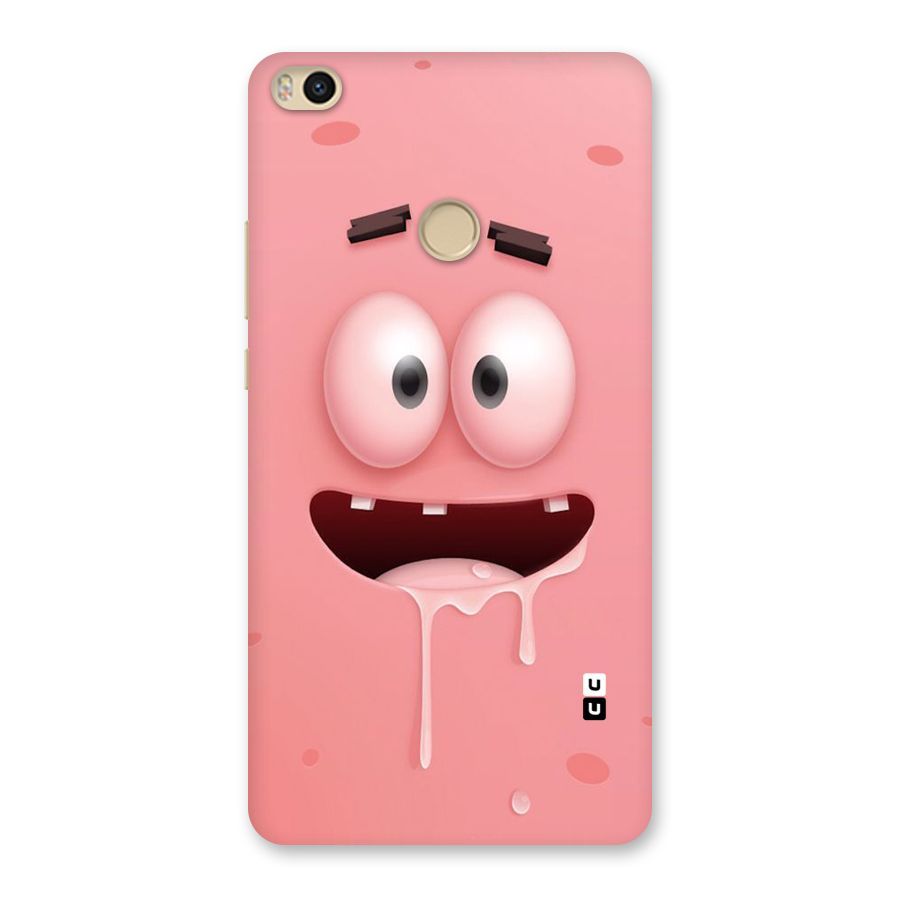 Watery Mouth Back Case for Mi Max 2